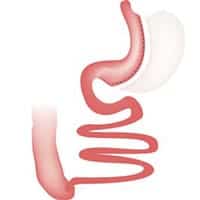 quelle imc pour bypass quelle différence entre bypass et sleeve centre obesite est essonne docteur girodet matthieu docteur bassam tantawi obesite paris quelle imc pour bypass quelle différence entre bypass et sleeve centre obesite est essonne docteur girodet matthieu docteur bassam tantawi obesite paris