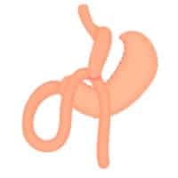 quelle imc pour bypass quelle différence entre bypass et sleeve centre obesite est essonne docteur girodet matthieu docteur bassam tantawi obesite paris quelle imc pour bypass quelle différence entre bypass et sleeve centre obesite est essonne docteur girodet matthieu docteur bassam tantawi obesite paris